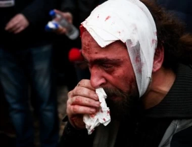 Ξένα ΜΜΕ για συλλαλητήριο στο Σύνταγμα: «Γρονθοκοπήθηκε επικίνδυνα στο πρόσωπο από αγνώστους»